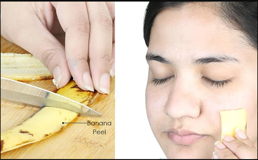 banana