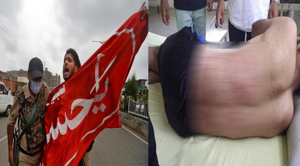 কাশ্মীরে মহররমের মিছিলে গুলি